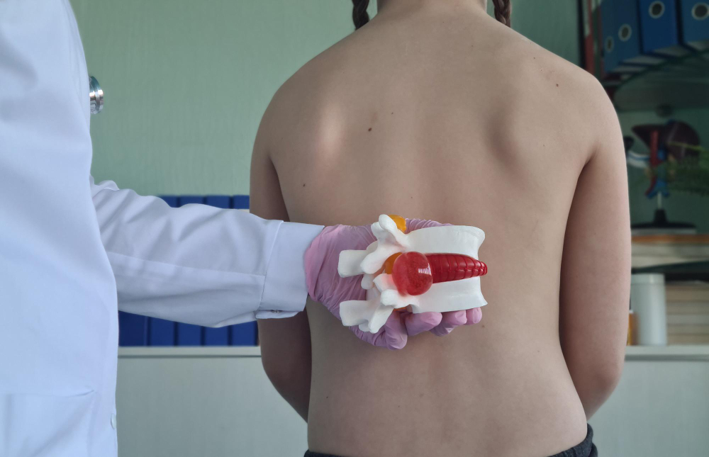 Vertebroplastia y Cifoplastia en Cancún: Tratamientos seguros para fracturas vertebrales