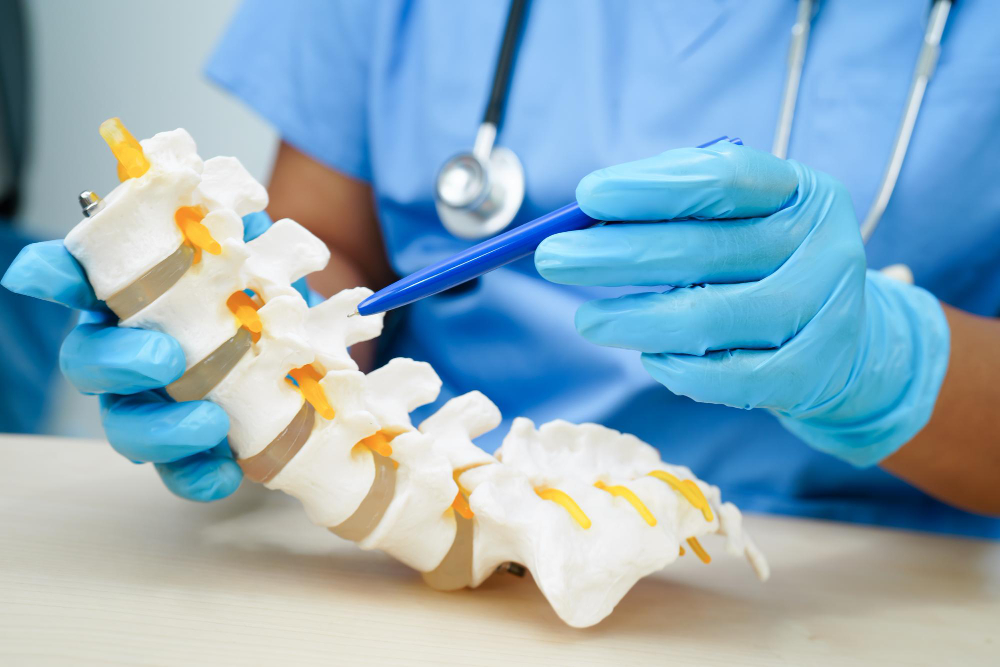 Vertebroplastia y Cifoplastia en Cancún: Tratamientos seguros para fracturas vertebrales